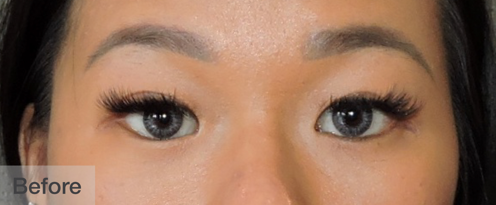 Close-up of a woman's eyes before eyelash enhancement showing natural lashes | Dr. Rodger Davies