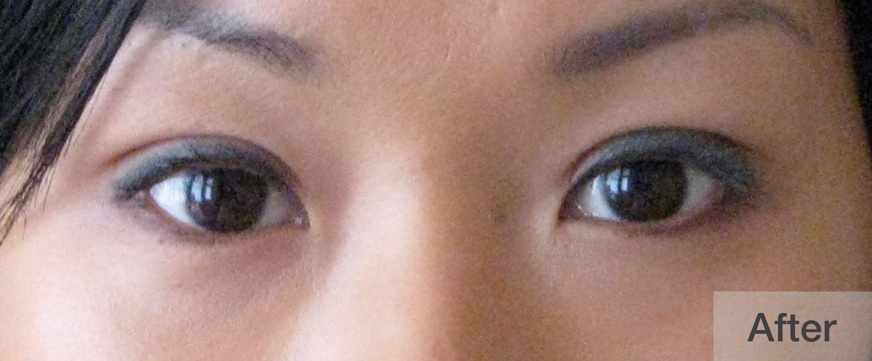 Close-up of a woman's eyes after eyelash enhancement showing fuller | Dr. Rodger Davies
